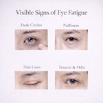 Load image into Gallery viewer, Llusso - LumiRevive Eye Device