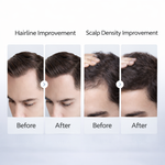 Load image into Gallery viewer, Llusso - TrichoLux LED Scalp Care Cap