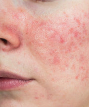 Best Korean Skincare for Sensitive Skin: A Gentle Guide