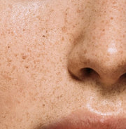 How to Fade Dark Spots and Hyperpigmentation