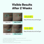 Load image into Gallery viewer, PDRN Reedle Shot Firming Eye Cream (0.51 Fl Oz / 15Ml), Ultra-Micro Vibration Eye Cream for Firming &amp; Elasticity, Targeted Wrinkle Care, PDRN Collagen, Korean Skincare