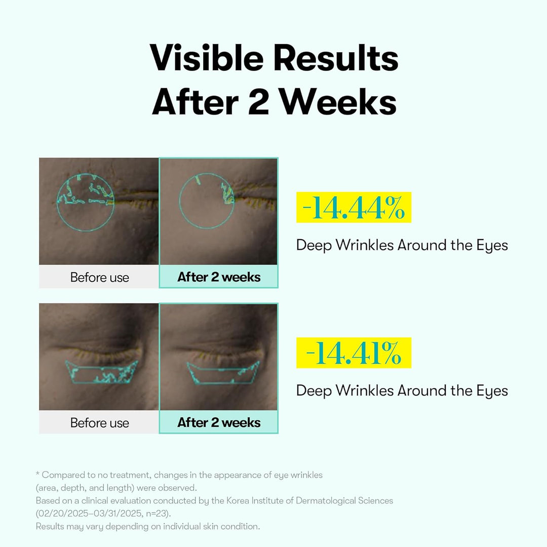 PDRN Reedle Shot Firming Eye Cream (0.51 Fl Oz / 15Ml), Ultra-Micro Vibration Eye Cream for Firming & Elasticity, Targeted Wrinkle Care, PDRN Collagen, Korean Skincare